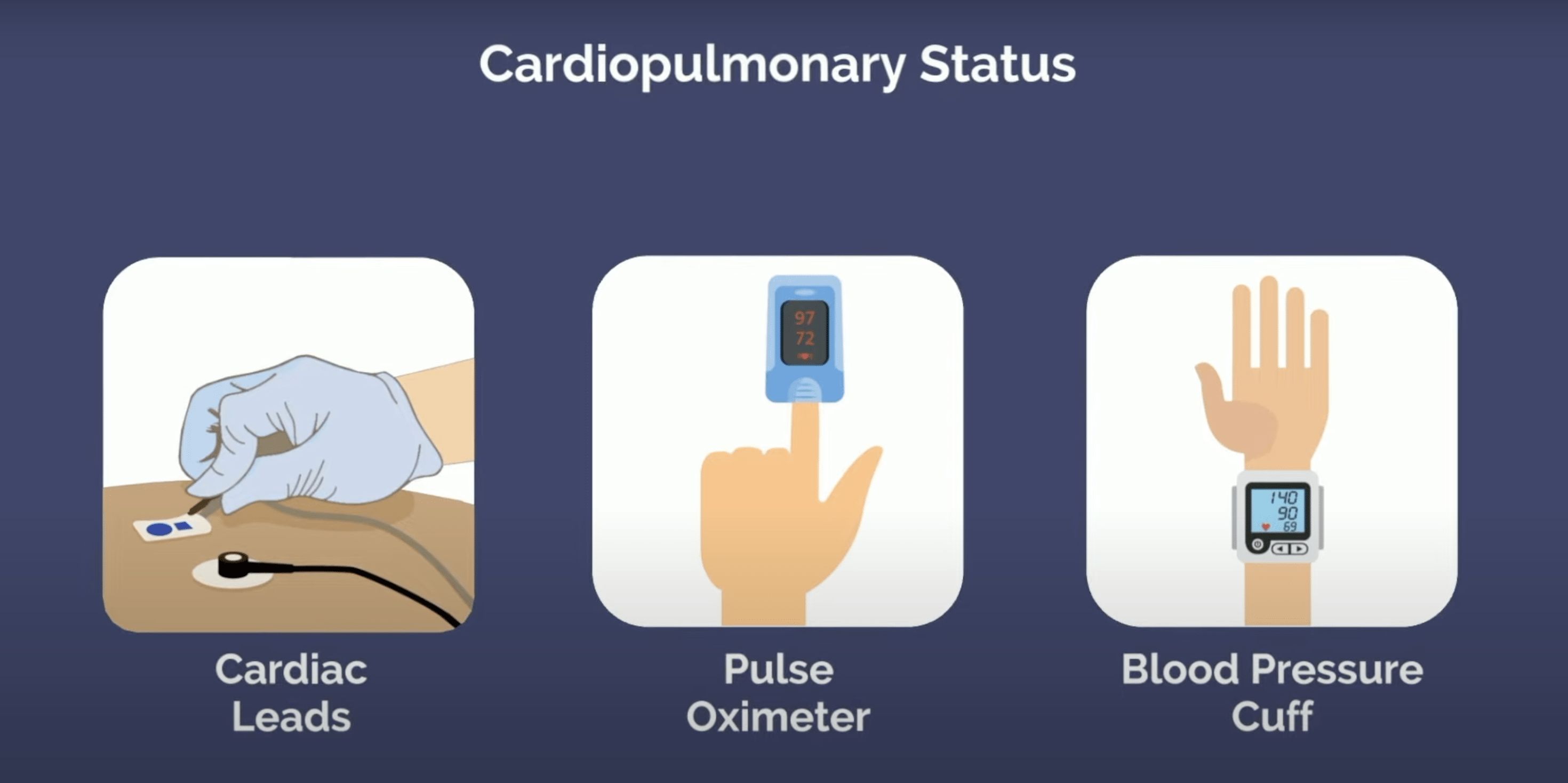 How anesthesiologists monitor the cardiopulmonary status of a patient
