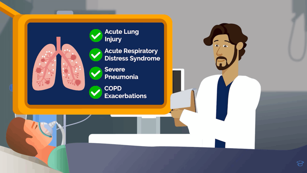 Illustration of a pulmonologist in the ICU reviewing conditions such as acute lung injury, acute respiratory distress syndrome, severe pneumonia, and COPD exacerbations while a patient is on a ventilator in a hospital bed.